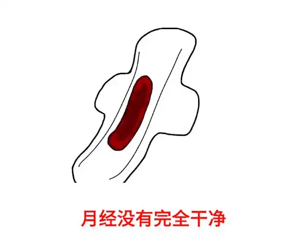 咦,你的内裤上怎么有褐色的分泌物?