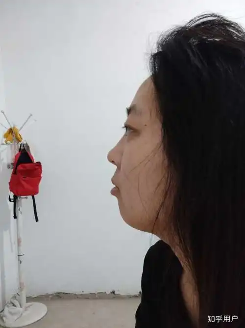 侧脸超级丑是什么体验?