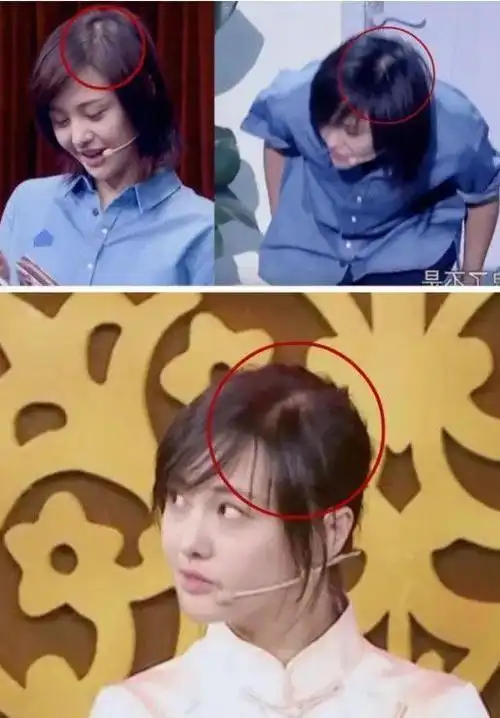 郑爽颜值已走下坡路?生图精修图被批差异大,黑眼圈重发量太少了