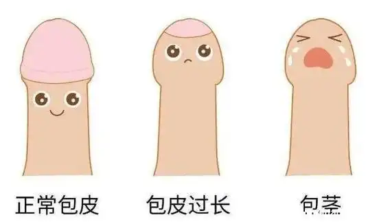 包茎手术20天恢复图片,男生割包茎会变大吗(注意x生活需一个月后)