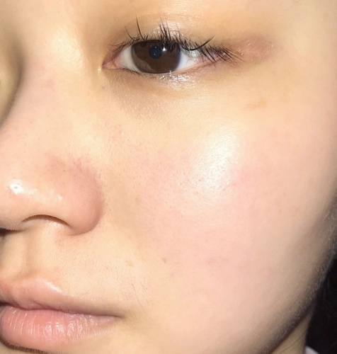 脸上毛孔"粗大肥胖",这4个原因是凶手,拯救毛孔只需3步骤