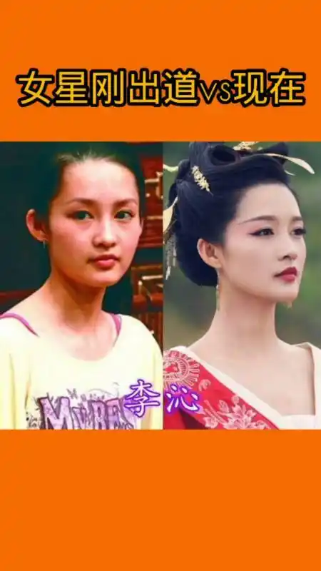 女星#有种"整容"叫公司包装,金晨褪去婴儿肥,李沁甜美,阚清子依旧