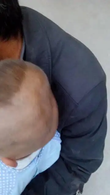 问:小孩头大,脑后凹凸不平,是怎么回事