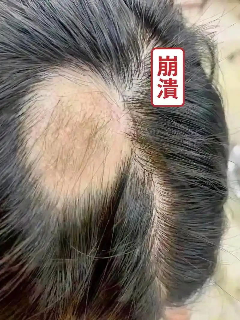 "老公,你压到我头发了"!#防脱生发 #年纪轻轻秃头了怎么办 - 抖音