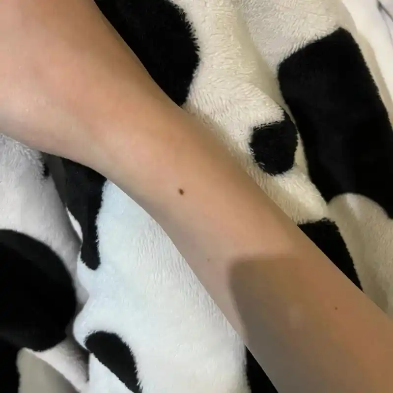 手腕突然长了颗痣… 到底是熬夜熬的还是有什么寓意啊啊啊啊啊啊啊,就