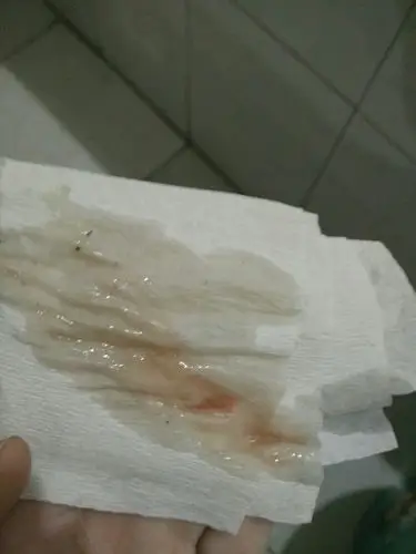 月经是上个月的20号来的,到26,27结束的.但是最近5天都有少量血丝.