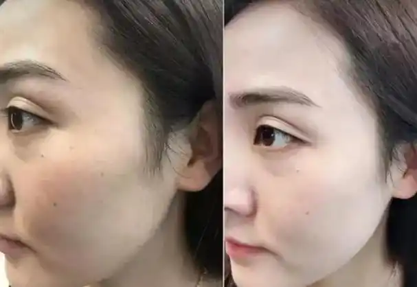 所以很多人千方百计地找寻祛斑方法,那么美白祛斑霜真的能去掉脸上的