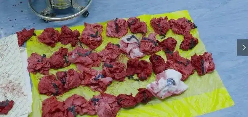 angelababy你凭什么劝女人趁年青年头的时候多生孩子