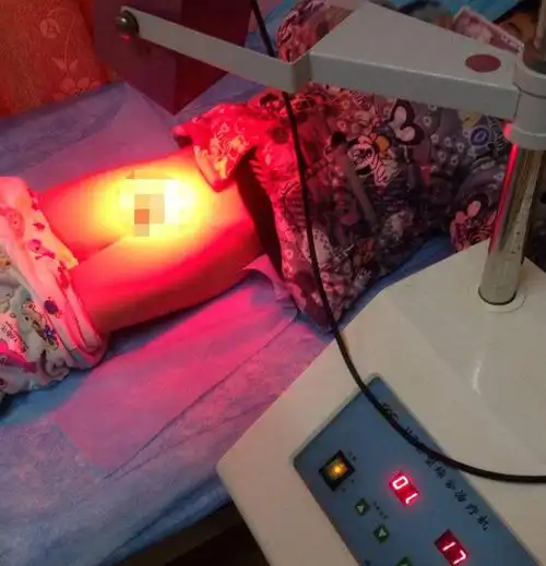 儿童包皮过长都需要做手术吗