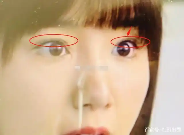 毛晓彤被曝整容?baby化妆师吐槽她医生不行,眼角开口出现后遗症