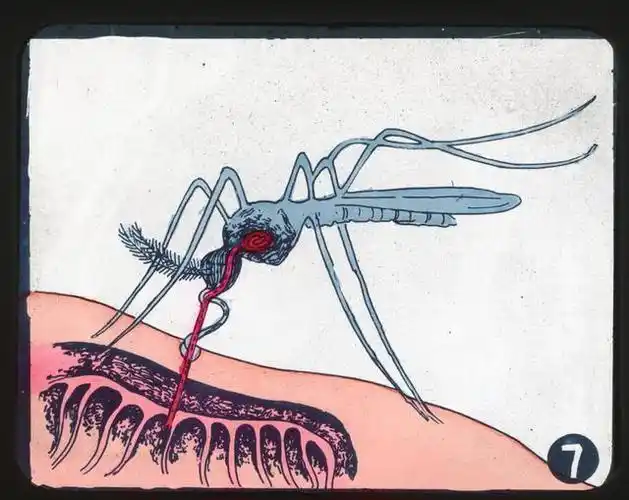 1个土方法,整夜开窗不用怕