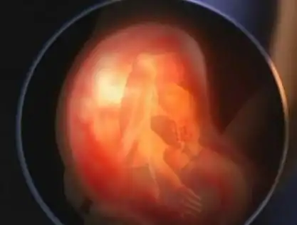 怀孕第40周胎儿图