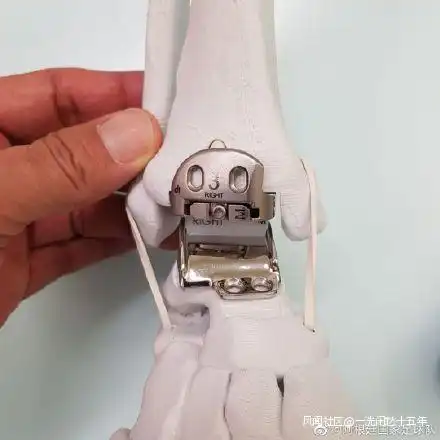 "战神"巴蒂斯图塔左腿成功手术换上义肢