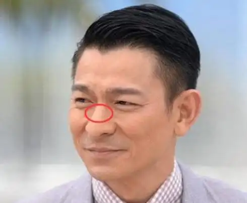 如果身上有这种特征的人"最有钱",天生好福气,名利双收|耳朵|疾厄宫