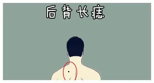 身体5颗巨富痣,只要一个,男人掌权,女人纳福,福泽子子辈辈!