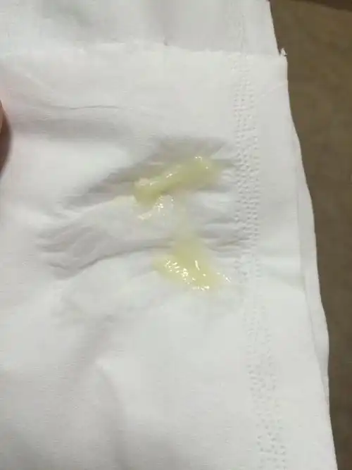 白带这样的,求解答,是属于什么炎症