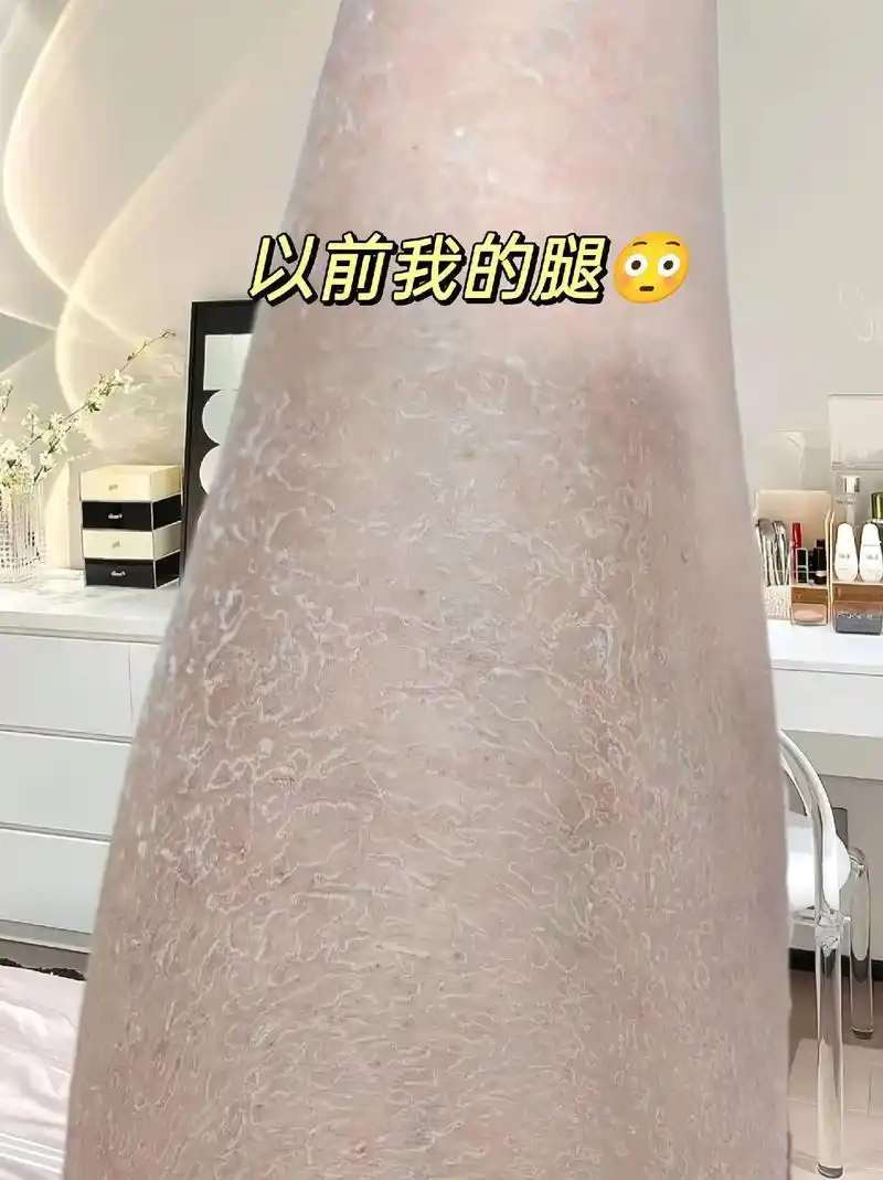 皮肤干燥粗糙,又显老!