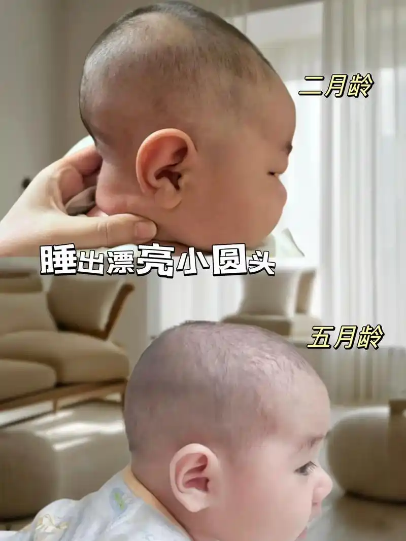 我发现了一款超棒的婴儿定型枕哦,真的轻松就解决了偏头扁头的问题呢!
