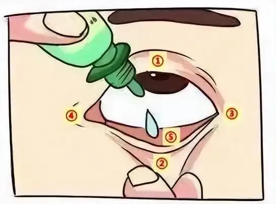 滴眼药水,涂眼药膏,你真的会用吗?|下眼睑|内眼角|制剂|眼膏_网易订阅