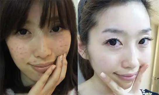 首页 文章项目 皮肤中心 李天巧        华美皮肤激光美肤医生