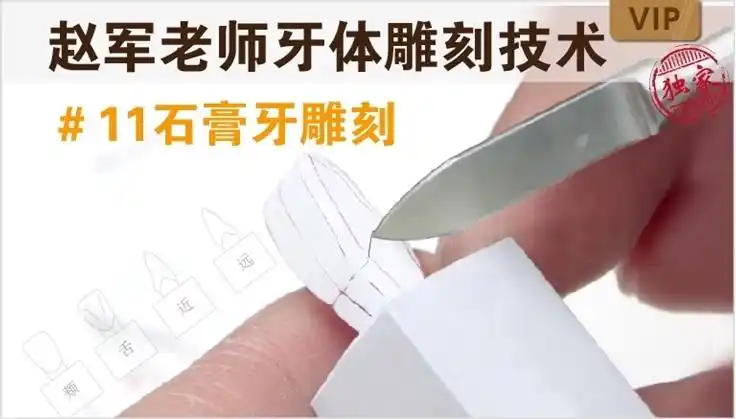 本片分三个课程展示了上颌中切牙1:1石膏牙雕刻的全过程及其雕刻技术.