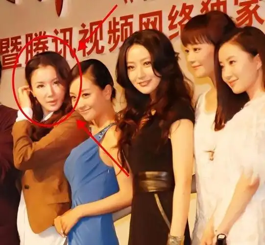 曾经美得惊人现在脸肿似发面馒头这几位中年女星越活越走样了