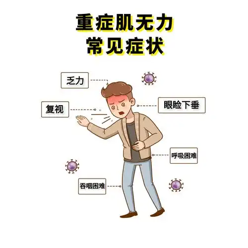 重症肌无力