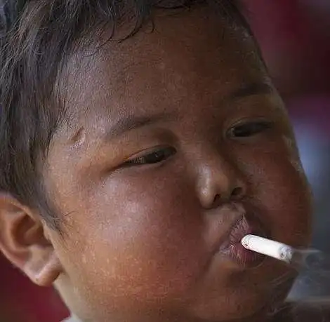 2岁小男孩一天要抽40支烟,如今天8年过去了,他现在变成什么样了