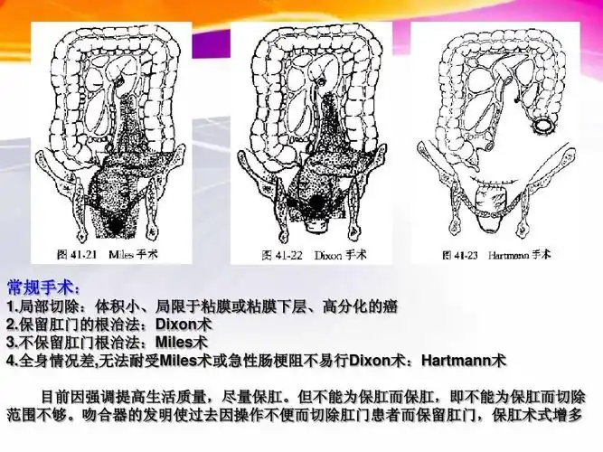 直肠癌的护理ppt