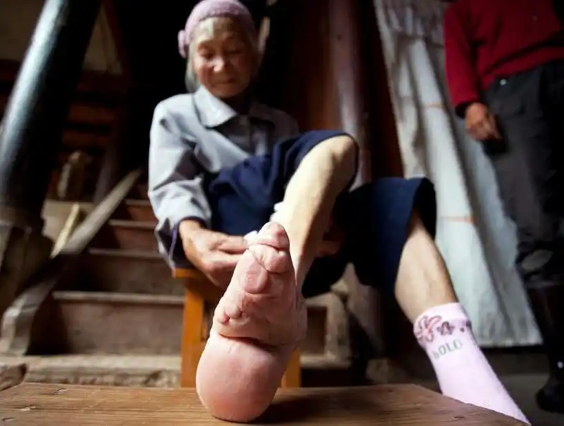 那些年的裹脚老人这才是原始的小脚太太最后一张让人不忍直视