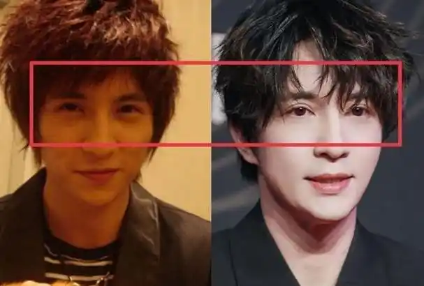 现如今的薛之谦整容后遗症变得越来越严重,曾经处于恢复期的薛之谦