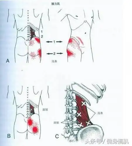 髋外展肌(臀中肌臀小肌)力量弱,会导致髋外展动作由单侧腰方肌收缩