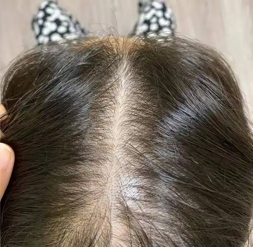 头发_精华_调整