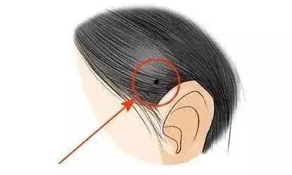 妨夫痣是什么意思(男人妨夫痣是什么意思)-生活常识-江湖救急网