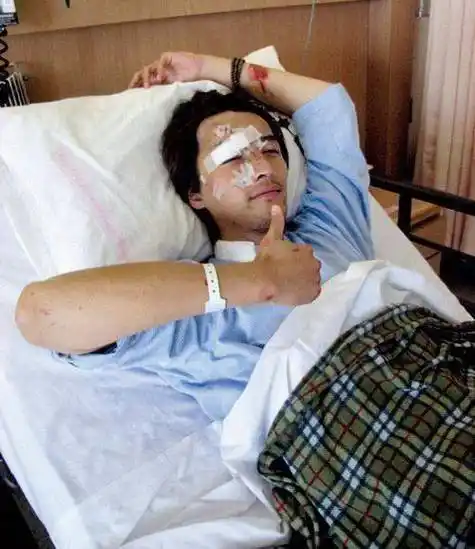 熊梓淇雨天遇车祸,车门撞变形惨况触目惊心,网友:想起胡歌车祸_事件