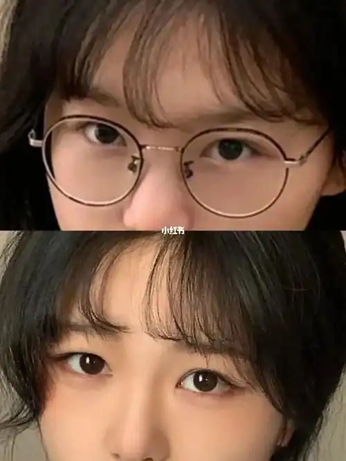 请爱护双眼高度近视戴眼镜太痛苦了