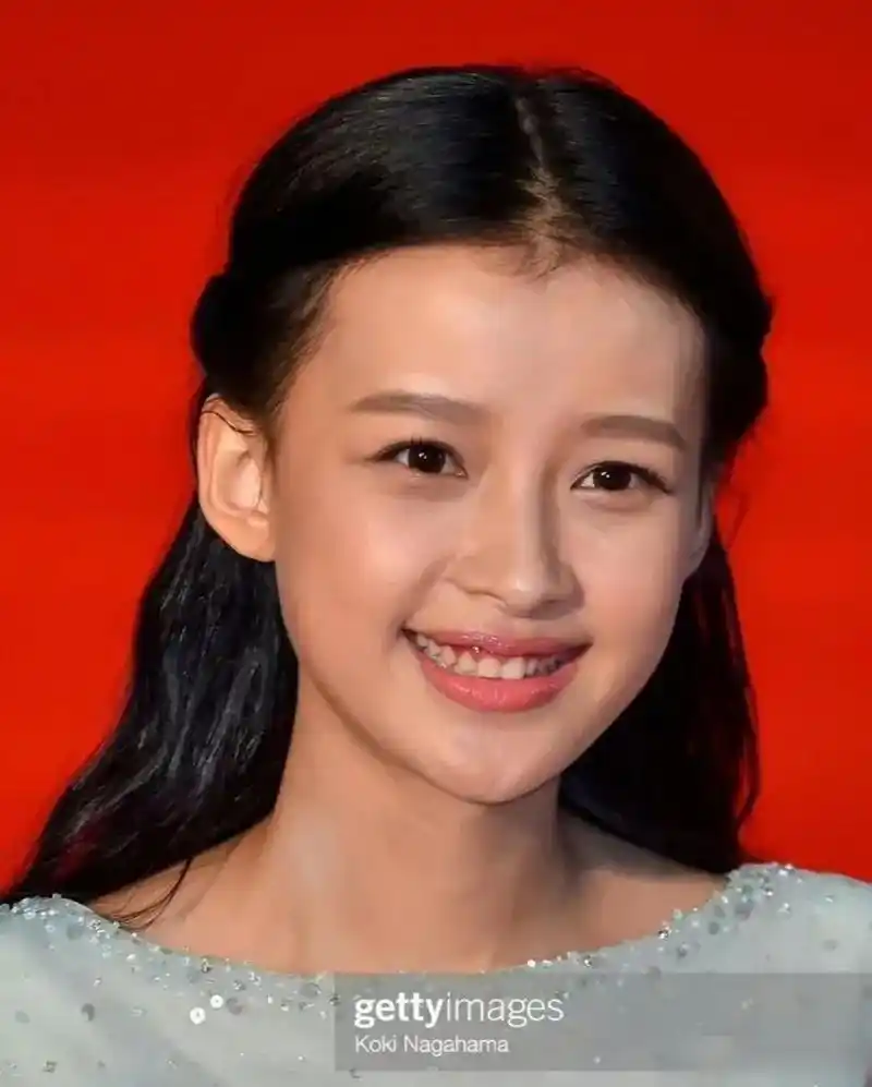 孙怡和刚出道时比确实有变化,双眼皮做得太宽了显老