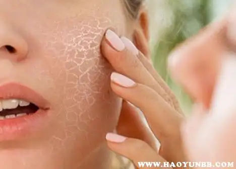 换季皮肤变差换季皮肤粗糙