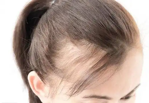 发量少的女生,不适合梳这3种"发型",小心看起来更秃!