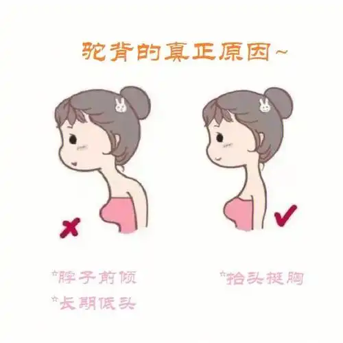 自己确切感受,因为脖子前倾长期低头造成驼背,在平时一定要纠正自己的