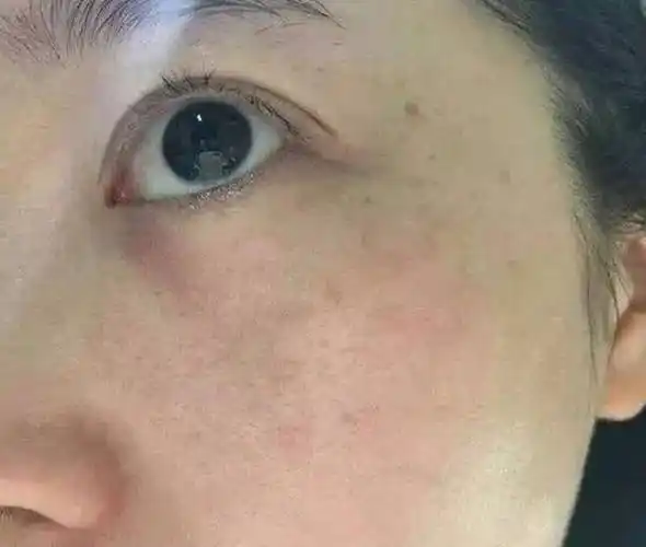 怎么调理脸色发黄暗沉(脸色发黄发暗怎么调理)-大恒文化