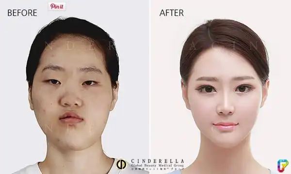 15张韩国整容对比图原本看完女生的已经超震撼,结果看到男生的才发现