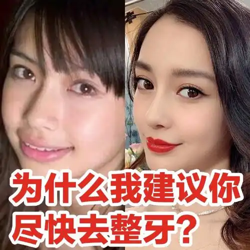 angelababy整容10次,整牙8次?ab为什_圈子-新氧美容整形