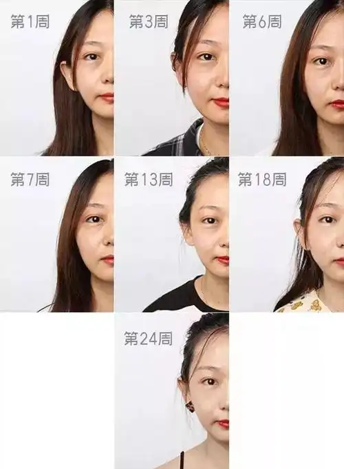 真人测试,连续熬夜一个月能变多丑