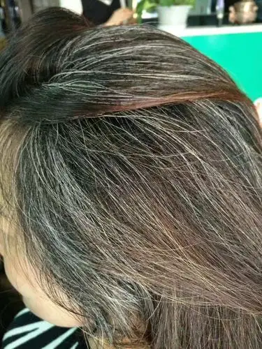 白发这么多,到底为什么? - 美篇