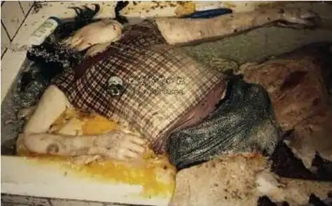 能把人恶心到吐的图片,世界十大最恶心的图片(胆小勿入)