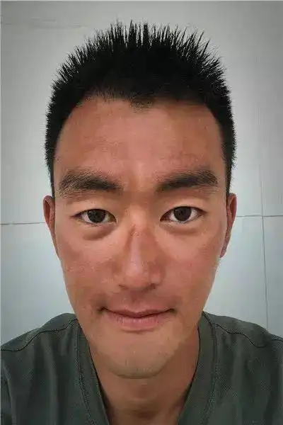 兵哥晒黑进度条▓▓▓▓▓▓▓第1天