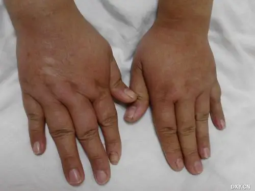 丁香园论坛 - 专业医生社区,医学,药学,生命科学,科研学术交流