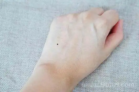 手臂有痣的女孩(手臂有痣的女人的说说)