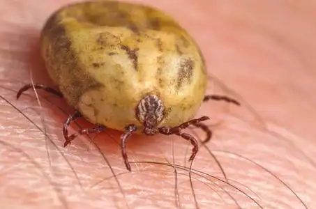 满腔热血坐在人体皮肤上的蜱虫照片